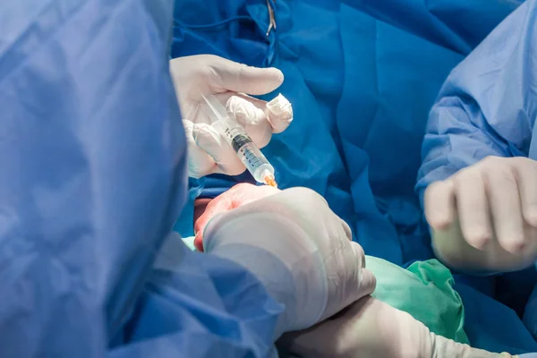 Médicos Que Realizan Una Cirugía Mano — Foto de Stock