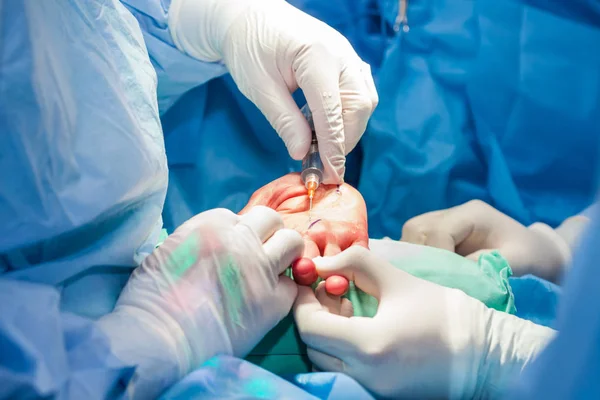 Médicos Que Realizan Una Cirugía Mano — Foto de Stock