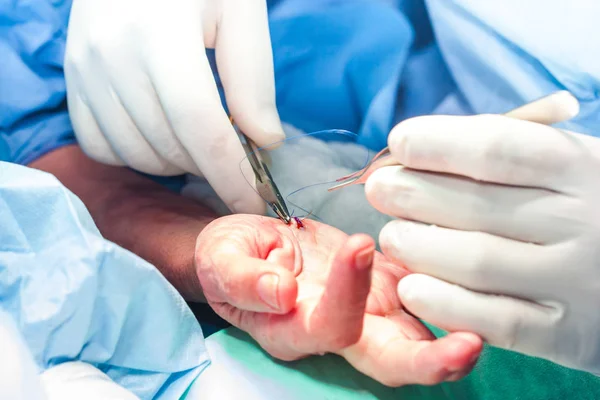 Chirurg näht die Hand eines Patienten am Ende der Operation — Stockfoto