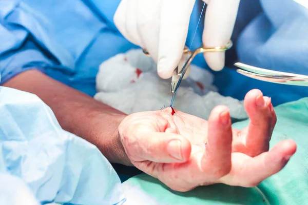 Cirurgião suturando a mão de um paciente no final da cirurgia — Fotografia de Stock