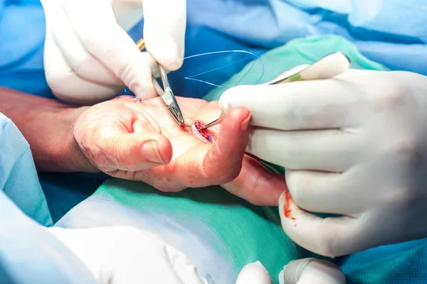 Chirurg szwu ręki pacjenta pod koniec zabiegu — Zdjęcie stockowe