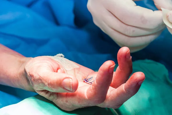 Chirurg bandagiert die Hand eines Patienten am Ende der Operation — Stockfoto