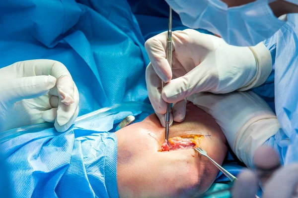对病人手臂进行手术的整形外科医生小组 — 图库照片