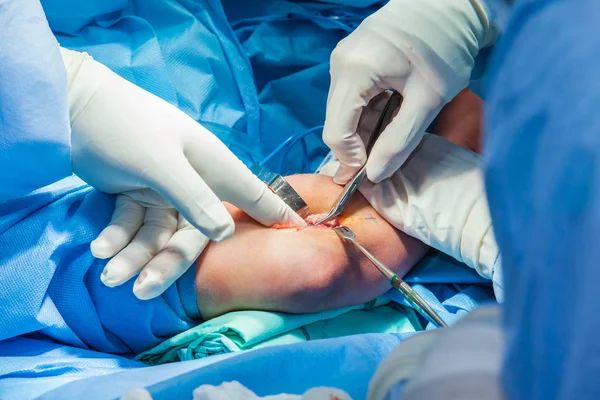 Группа хирургов-ортопедов, выполняющих операцию на руке пациента — стоковое фото