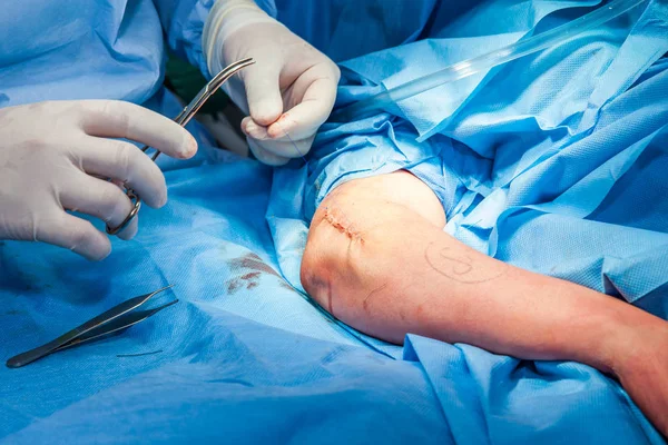 Chirurg szwu ramienia pacjenta pod koniec zabiegu — Zdjęcie stockowe