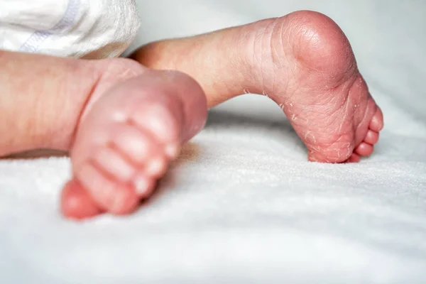 Маленькая белая кожа новорожденные ноги на белой спине — стоковое фото
