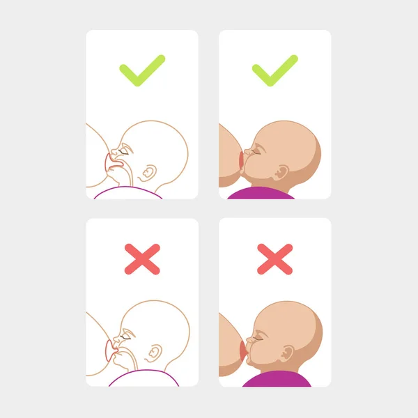 Emzirme pozisyonu doğru. Anne bebeği emziriyor. Yanlış poz. Anne emzirme sütü.