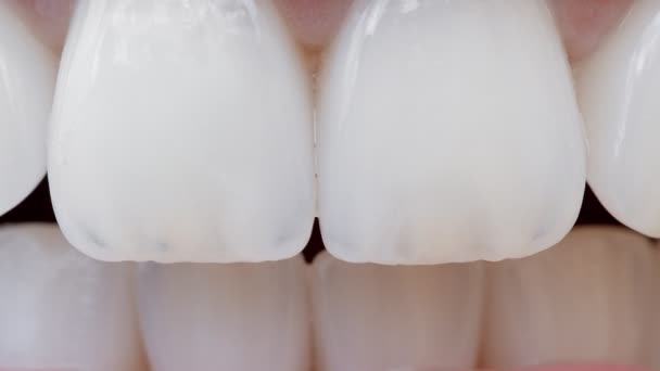 Los dientes delanteros se cierran. Dientes frontales femeninos blancos perfectos de cerca — Vídeos de Stock