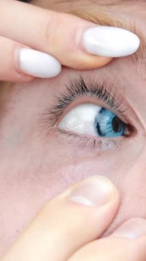 Temas Lenslerini Mavi Göze Uygulayacak Adam. Ophthalmology Outdoor sırasında beyaz manikürlü sakallı erkeğe yardım eden kadın ellerini kapatın. Görüş Konsepti.