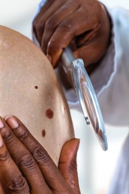 Yaşlı kadın dermatolog da check-up oluyor.,usig büyüteç