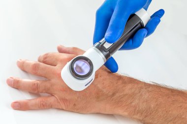 Hastanede büyüteç ile cilt kontrolü için yaşlı kadın danışmanlık doktor