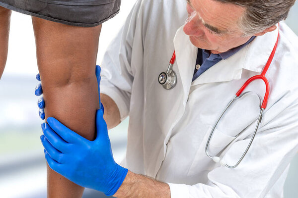 phlebologists examination -Varicose veins on the womans legs close up