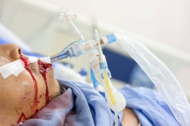 Ağzı ve burun boşluğu kanayan kriz hastaları kendilerine yardım edemiyorlar. Solunum cihazı her zaman gereklidir..