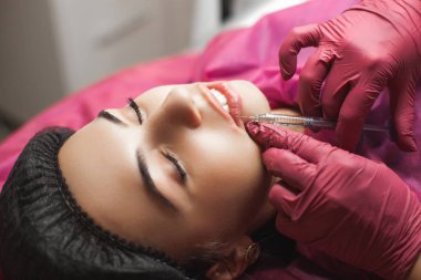 Kozmetolojist yapma prosedürü. Dermatoloğa hyaluronik asit enjeksiyonu yapıyor. Dudak enjeksiyonu yla kapatın. Dudak güçlendirici prosedürü. Güzellik salonu servisi.