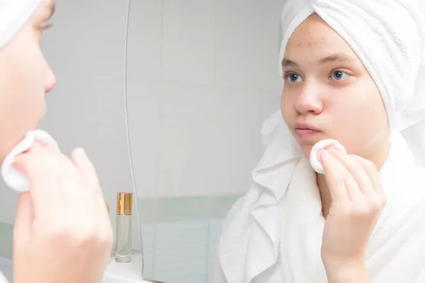 Gadis Dalam Mantel Putih Menggosok Wajahnya Dengan Swab Kapas Depan — Stok Foto