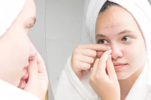Girl Towel Her Head Morning Front Mirror Squeezes Pimple — Stock Photo, Image