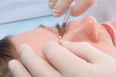 Yakın plan, steril eldivenli doktor, kaşı büyümesi için bir kadına güzellik iğnesi yapıyor.