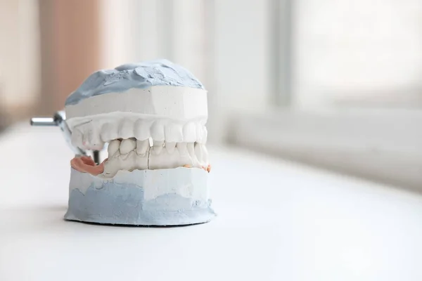 Jaws alçı döküm. Diş döküm alçı model protez laboratuvarında insan Jaws. Diş Hekimliği Ortodonti. Yakın çekim. 
