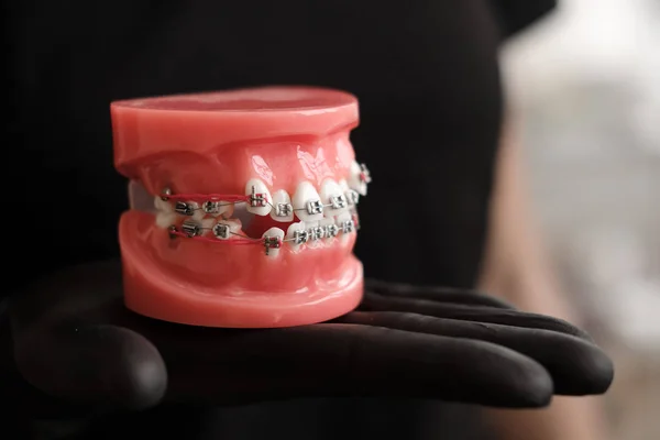 Dişçi diş döküm tutarak siyah eldiven modeli diş protez laboratuvarında telleri ile insan Jaws. Diş Hekimliği Ortodonti. Yakın çekim. seçici odak