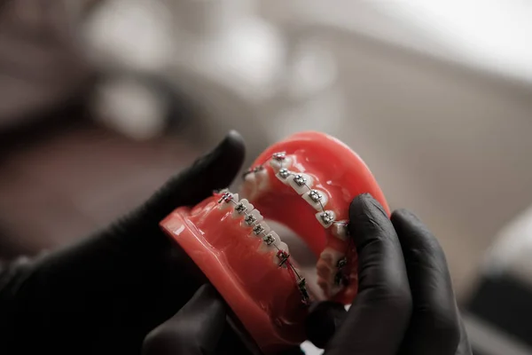 Dişçi Diş Döküm Tutarak Siyah Eldiven Modeli Diş Protez Laboratuvarında — Stok fotoğraf