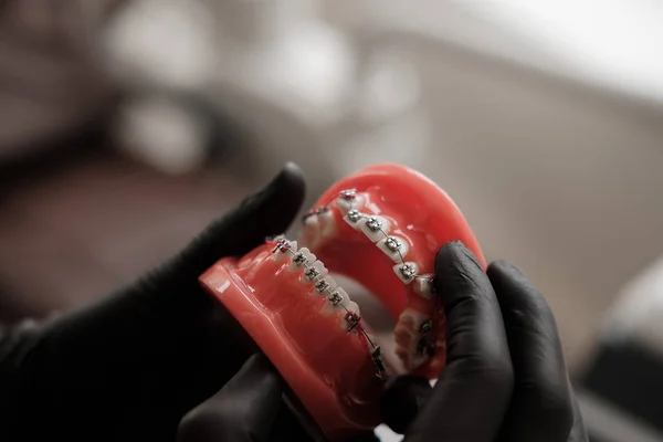 Dentista Con Guantes Negros Sujetando Mordazas Humanas Modelo Casting Dental —  Fotos de Stock