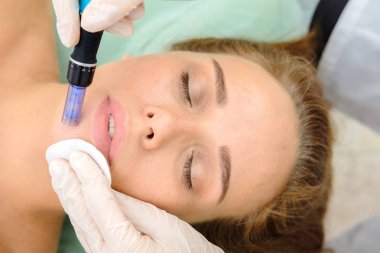 Kozmetik uzmanı mesoterapi enjeksiyonu yapıyor. Mikro-edle mezoterapi. Güzellik uzmanında tedavi gören kadın. Donanım kozmetolojisi. Mezoterapi, cilt bakımı, yüz bakımı, yüz yenileme. Kapat.