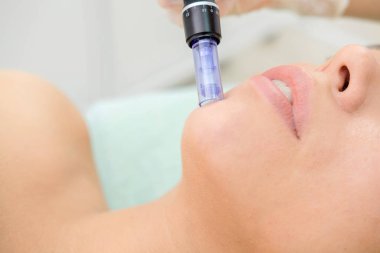 Kozmetik uzmanı mesoterapi enjeksiyonu yapıyor. Mikro-edle mezoterapi. Güzellik uzmanında tedavi gören kadın. Donanım kozmetolojisi. Mezoterapi, cilt bakımı, yüz bakımı, yüz yenileme. Kapat.