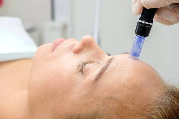 Cosmetologist making mesotherapy injection. Microneedle mesotherapy. Treatment woman at beautician. Hardware cosmetology. Mesotherapy, dermapen, treatment of face zone, face rejuvenation.  Close up