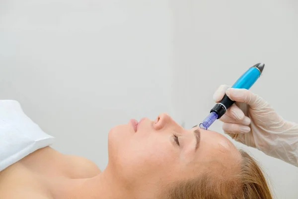 Kosmetolog Provádějící Mezoterapeutickou Injekci Mezoterapie Mikrojehlou Léčitelka Kosmetice Hardwarová Kosmetika — Stock fotografie