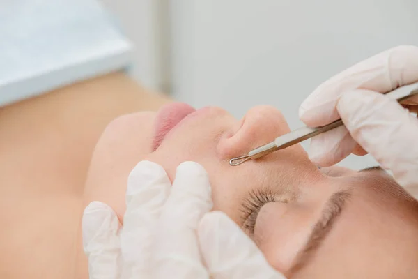 Procedimento Para Limpeza Pele Com Ferramenta Aço Cravos Acne Limpeza — Fotografia de Stock