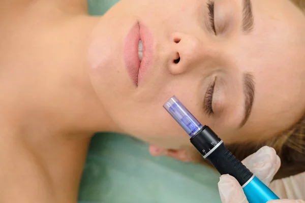 Cosmetologist making mesotherapy injection. Microneedle mesotherapy. Treatment woman at beautician. Hardware cosmetology. Mesotherapy, dermapen, treatment of face zone, face rejuvenation.  Close up