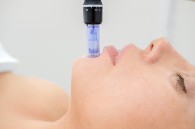 Kozmetik uzmanı mesoterapi enjeksiyonu yapıyor. Mikro-edle mezoterapi. Güzellik uzmanında tedavi gören kadın. Donanım kozmetolojisi. Mezoterapi, cilt bakımı, yüz bakımı, yüz yenileme. Kapat.
