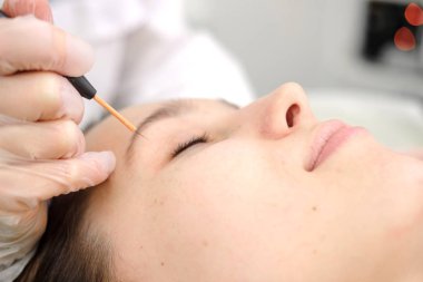 Kadın hastanın yüzüne Doğum lekesi tıbbi tedavi çıkarılması. Kadın dermatolog cerrah mol kaldırmak için elektrokoter kullanarak. Radyo dalgası elektrokoagulasyon kaldırma yöntemi. Yakın çekim