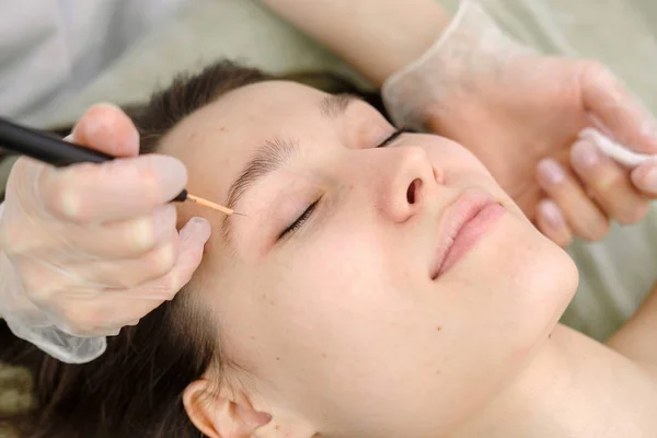 Remoção Tratamento Médico Marca Nascença Rosto Paciente Feminino Cirurgiã Dermatologista — Fotografia de Stock