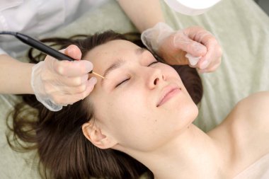 Kadın hastanın yüzüne Doğum lekesi tıbbi tedavi çıkarılması. Kadın dermatolog cerrah mol kaldırmak için elektrokoter kullanarak. Radyo dalgası elektrokoagulasyon kaldırma yöntemi. Yakın çekim