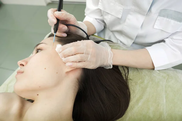 女性患者の顔からの母斑の治療除去 女性の皮膚科医は ほくろを除去するための専門の電気焼灼を使用しています 電波電気凝固除去法 — ストック写真