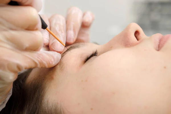 Remoção Tratamento Médico Marca Nascença Rosto Paciente Feminino Cirurgiã Dermatologista — Fotografia de Stock