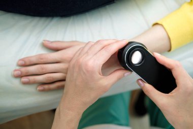 Deri muayene yaparken profesyonel bir dermatoskop kullanan kadın dermatolog, eldeki benign benler kontrol. Dermatolog, kadın bir hastada Doğum izleri ve benleri inceliyor. Dermatoloji Kliniği