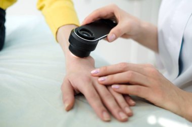 Deri muayene yaparken profesyonel bir dermatoskop kullanan kadın dermatolog, eldeki benign benler kontrol. Dermatolog, kadın bir hastada Doğum izleri ve benleri inceliyor. Dermatoloji Kliniği