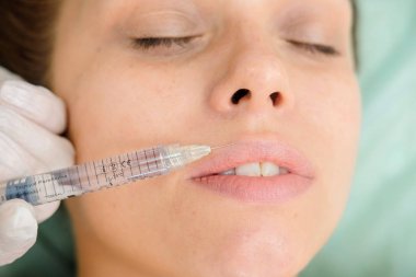 Dudak dolgu enjeksiyonları. Tombul dudaklar büyütme. Güzellik plastik. Kadın hasta için mezoterapi yapan kozmetolojist. Şırınga ve iğne, yüz kozmetik güzellik enjeksiyonu.