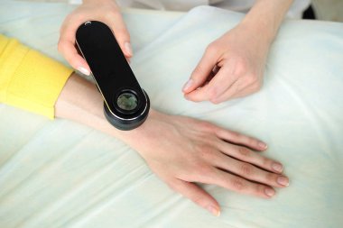 Deri muayene yaparken profesyonel bir dermatoskop kullanan kadın dermatolog, eldeki benign benler kontrol. Dermatolog, kadın bir hastada Doğum izleri ve benleri inceliyor. Dermatoloji Kliniği