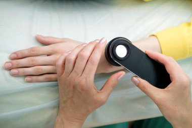 Deri muayene yaparken profesyonel bir dermatoskop kullanan kadın dermatolog, eldeki benign benler kontrol. Dermatolog, kadın bir hastada Doğum izleri ve benleri inceliyor. Dermatoloji Kliniği