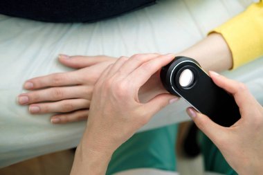 Deri muayene yaparken profesyonel bir dermatoskop kullanan kadın dermatolog, eldeki benign benler kontrol. Dermatolog, kadın bir hastada Doğum izleri ve benleri inceliyor. Dermatoloji Kliniği