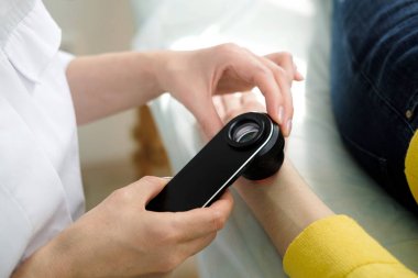 Deri muayene yaparken profesyonel bir dermatoskop kullanan kadın dermatolog, eldeki benign benler kontrol. Dermatolog, kadın bir hastada Doğum izleri ve benleri inceliyor. Dermatoloji Kliniği