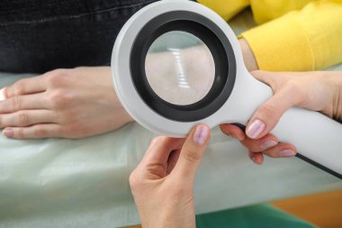 Deri muayene yaparken profesyonel bir büyüteç kullanarak dermatolog, eldeki benign benler kontrol. Dermatolog, kadın bir hastada Doğum izleri ve benleri inceliyor. Dermatoloji Kliniği