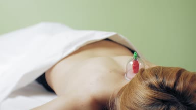 Geleneksel Çin tıp çukurluğu süreci. Akupunktur tedavisi kadın hasta kadın geri Hijamah bardak üzerinde. Geleneksel Çince tedavi. Tıbbi çukurluğu tedavisi donanımları.