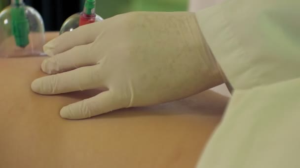 Tradizionale cinese Medicina Cupping processo. Tazze Hijamah sulla schiena di una paziente donna in terapia di agopuntura. Trattamento tradizionale cinese. Attrezzature per terapia di coppettazione medica . — Video Stock