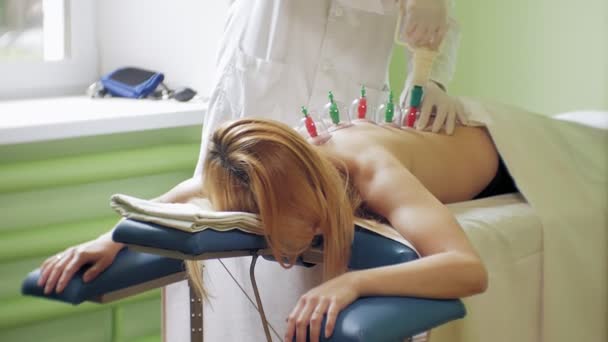 Tradizionale cinese Medicina Cupping processo. Tazze Hijamah sulla schiena di una paziente donna in terapia di agopuntura. Trattamento tradizionale cinese. Attrezzature per terapia di coppettazione medica . — Video Stock