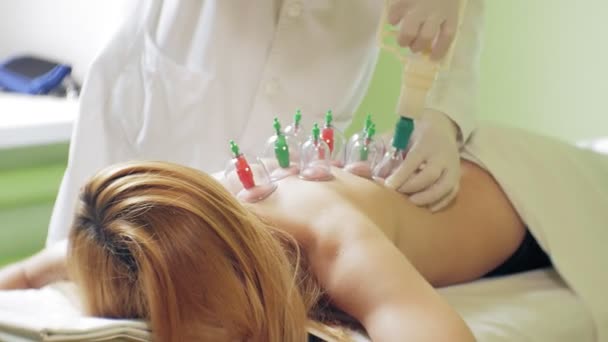 Tradizionale cinese Medicina Cupping processo. Tazze Hijamah sulla schiena di una paziente donna in terapia di agopuntura. Trattamento tradizionale cinese. Attrezzature per terapia di coppettazione medica . — Video Stock