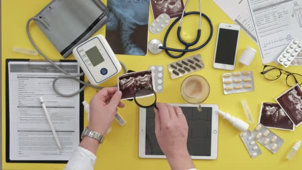 Terapistler masaüstü, EKG sonuçları bilgisayar tablet, ultrason, tıp ve sağlık kavramı üzerinde Üstten Görünüm — Stok video